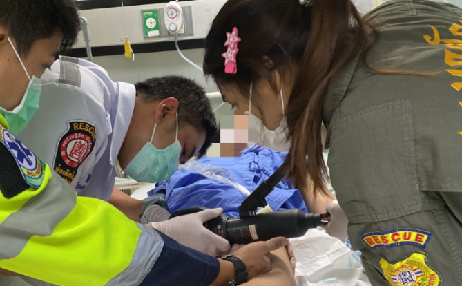 奇葩!泰国一名男子在生殖器官上套11个圆环,最终失去了知觉…